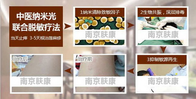 了解荨麻疹病因及早治疗效果好