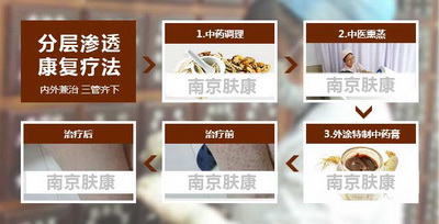 南京治疗鱼鳞病的专科医院